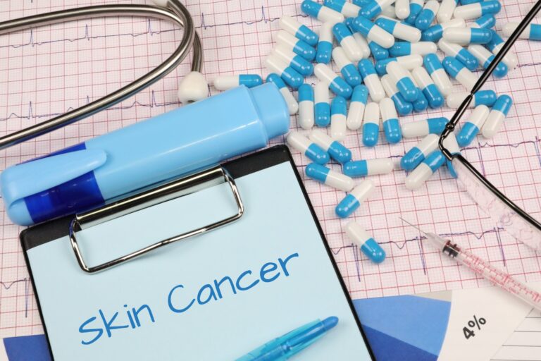 Skin Cancer Treatments: What Are Your Options?