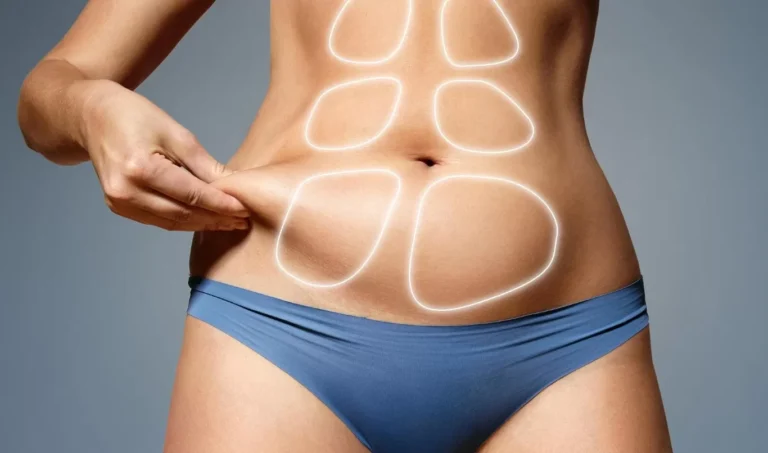 Tummy Tuck Myths and Facts: What You Need to Know