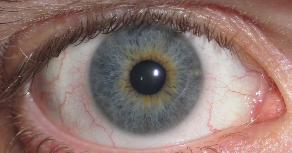 Why do my eyes feel dry and irritated all the time