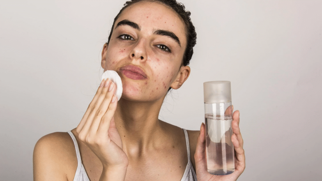 How to Build a Skincare Routine for Acne-Prone Skin