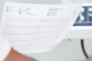 Why are regular ECG tests important for heart patients