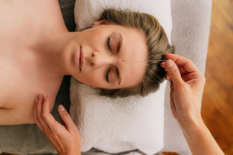 How Acupuncture Can Help with Stress and Emotional Balance