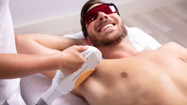 Laser Hair Removal for Men: Why It's Gaining Popularity