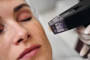 Understanding the Process and Benefits of Earlobe Repair