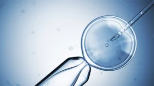 Is IVF a Good Treatment for Individuals With Unexplained Infertility?