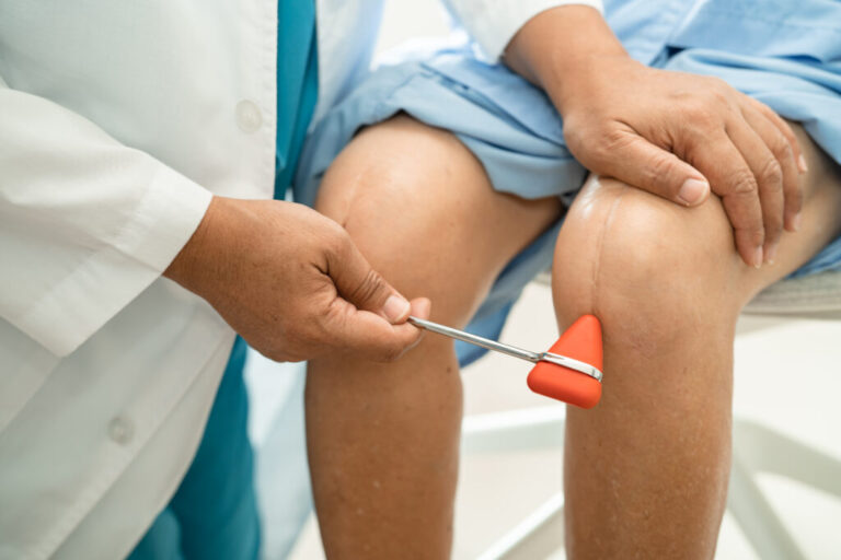Exploring the Use of Regenerative Orthopedics for Tendon Healing