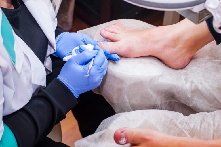 How Podiatrists Treat Common Foot Infections