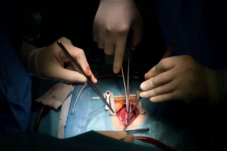 Key Tips for Effective Wound Care After Surgery