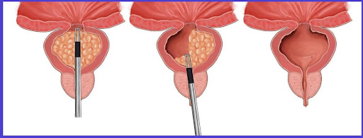 Surgical Techniques in Urology Surgical Techniques in Urology