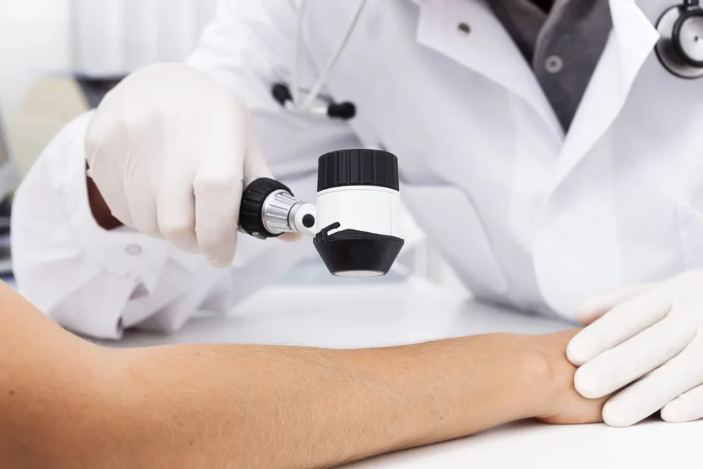 What a Dermatologist Looks for During a Skin Cancer Exam