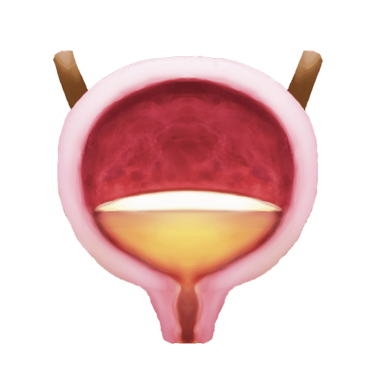 Home Remedies for a Urinary Tract Infection