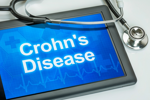 Understanding Crohn’s Disease and Its Impact Understanding Crohn's Disease and Its Impact